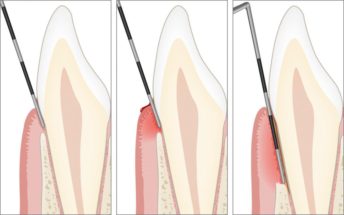 Clinical examination