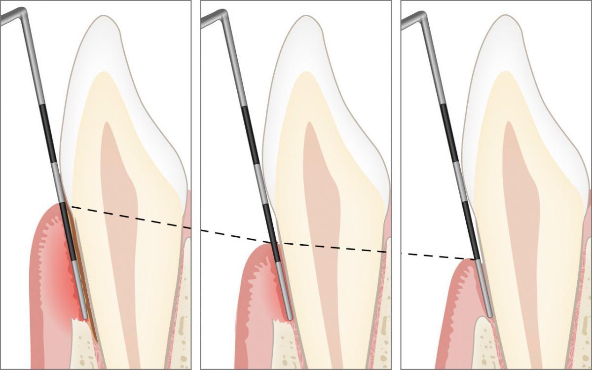 Follow-up (re-evaluation)