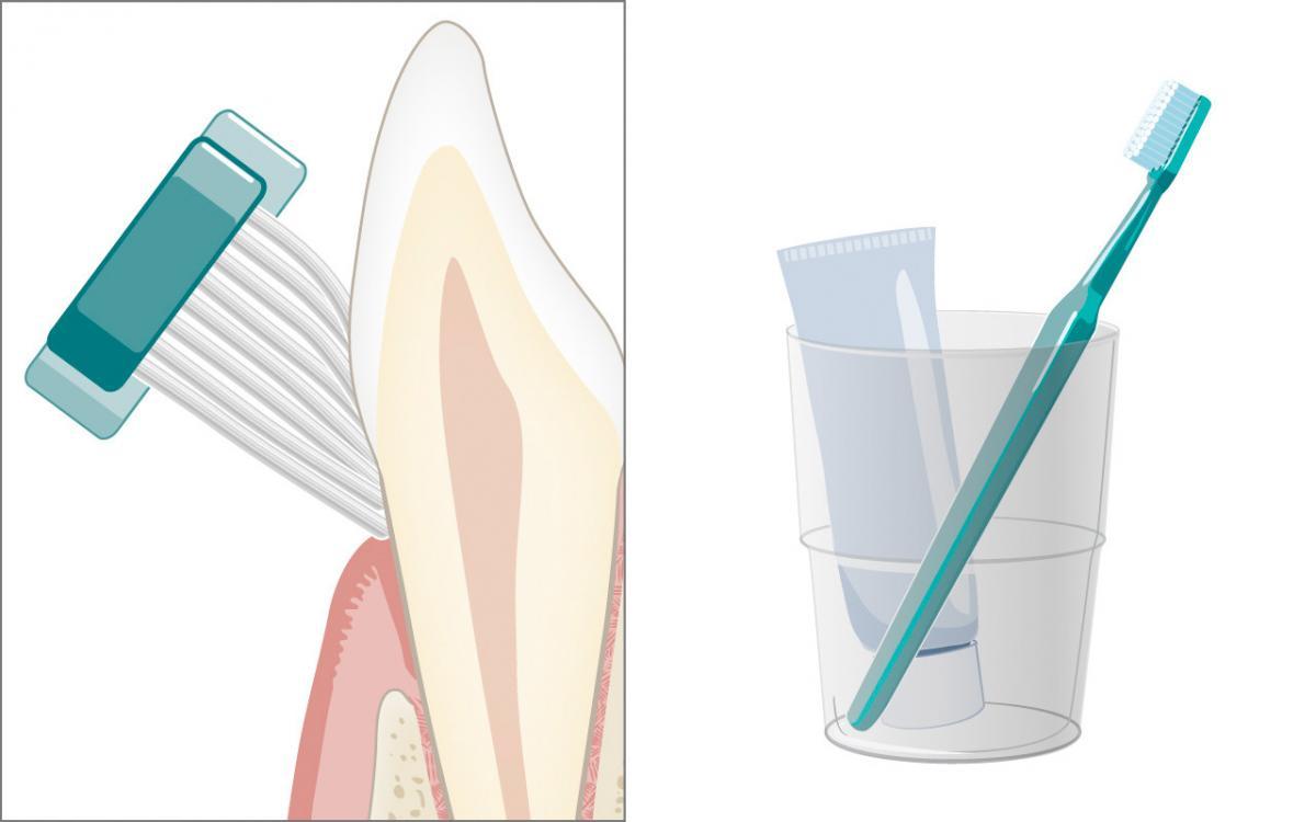 Optimizing oral hygiene